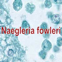 Naegleria Fowleri Ameba in St. Bernard Parish Water System