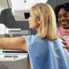 Spillover Effect: Revised Mammography Guidelines’ Unintended Impact on Breast Cancer Screening