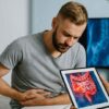 Sharp Rise in Appendix Cancer Among Millennials Sparks Medical Concern
